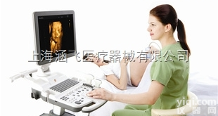 SonoAce R7  <em>三星</em><em>麦迪逊</em>彩超SonoAce R7 上<em>海涵</em>飞特卖