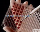 人强啡肽（Dyn）elisa实验试剂盒