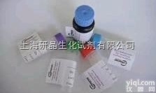 Anti-Mouse <em>IgA</em><em>抗体</em>,抗<em>小鼠</em><em>IgA</em><em>抗体</em>价格