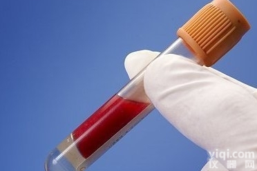 <em>CGBP</em><em>抗体</em>