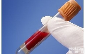 <em>gamma</em> <em>crystallin</em> S<em>抗体</em>