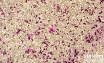 transwell<em>侵袭</em>