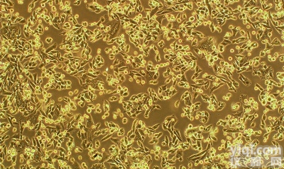 人<em>十二指肠</em><em>腺癌</em><em>细胞</em>,HuTu-80<em>细胞</em>