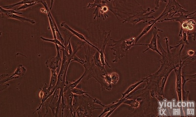 人脐<em>静脉</em><em>内皮</em> （具有T24<em>细胞</em>特性） ECV-304<em>细胞</em>