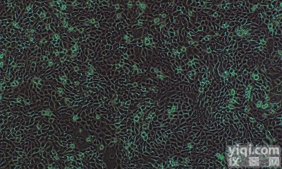 人<em>肾上腺</em><em>腺瘤</em><em>细胞</em>,NCI-H205<em>细胞</em>