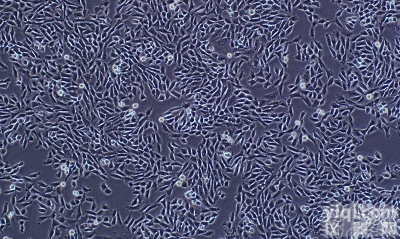 <em>小鼠肾足细胞,Mouse podocyte细胞</em>