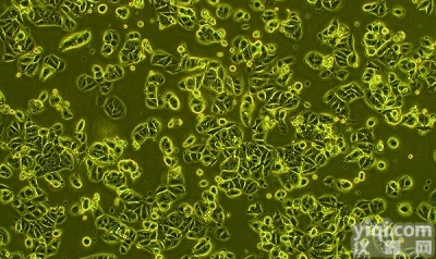 甲状<em>腺癌</em><em>细胞</em>（未<em>分化</em> ）ARO<em>细胞</em>