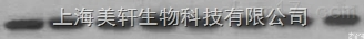 免疫蛋白印迹（WB,<em>Western</em> <em>Blot</em>）<em>技术服务</em>
