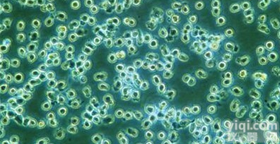 KSY-1<em>卡波</em>斯<em>肉瘤</em>细胞株