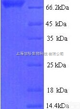 同类型<em>染色</em><em>单体</em><em>凝聚</em>蛋白4抗体
