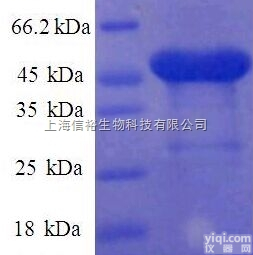 <em>南斯</em>-<em>霍兰</em>综合征蛋白<em>抗体</em>