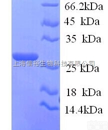 <em>溶酶体</em>α-<em>甘露</em><em>糖苷酶</em>2抗体