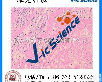 <em>病理切片</em>  <em>病理切片</em>