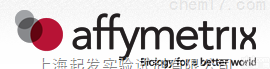 <em>Affymetrix</em> <em>芯片</em>平台介绍
