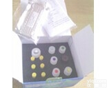 人<em>异常</em><em>凝血酶原</em>（APT）检测<em>试剂盒</em>