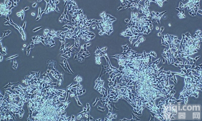 <em>小鼠</em><em>微血管</em><em>上皮</em>细胞