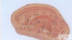 针灸<em>模型</em>（<em>耳部</em>按摩<em>模型</em>）