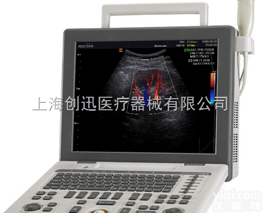 <em>SONOACE</em> R3  三星<em>麦迪逊</em>便携式<em>彩超</em><em>SONOACE</em> R3