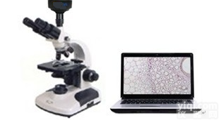 BX-303E  BX-303E电脑<em>生物数码显微镜</em>价格|数码显微镜生产厂家