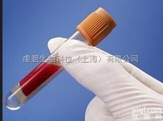 QB-6687  脑膜炎<em>奈瑟</em>菌多价抗<em>血清</em>2（X,Y,Z群）