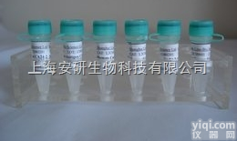 MMP8<em>蛋白</em><em>抗原</em>，基质金属<em>蛋白</em>酶-8/胶原酶2<em>蛋白</em><em>抗原</em>