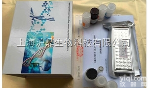 PKB  <em>蛋白</em><em>激酶</em>,人<em>蛋白</em><em>激酶</em>B（PKB）ELISA试剂盒价格