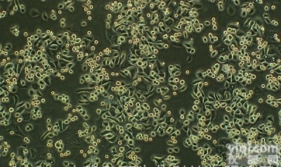 OMC-1：<em>人眼</em><em>脉络膜</em><em>黑色素瘤</em>细胞