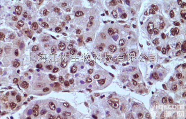 <em>免疫</em>组化<em>检测</em>（IHC）病理<em>检测</em><em>技术服务</em>