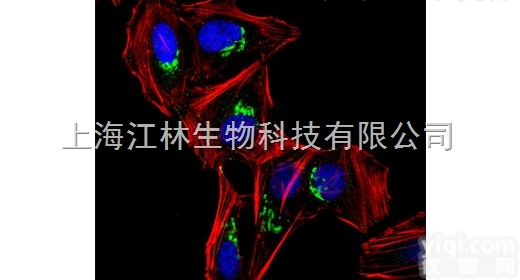 免疫<em>荧光</em><em>拍片</em>-病理技术服务