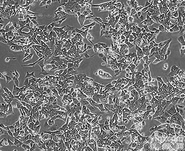 RGC-5<em>细胞</em>；<em>视网膜</em>神经节<em>细胞</em>