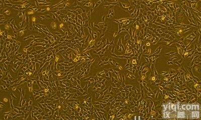 XC；前列腺<em>泡沫状</em>癌