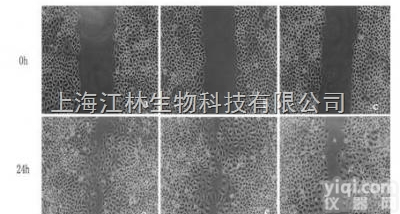 <em>细胞</em><em>划痕</em><em>技术服务</em>