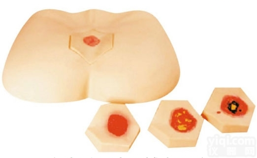 KAS/RC/3  <em>阶段</em><em>褥疮</em><em>护理模型</em>