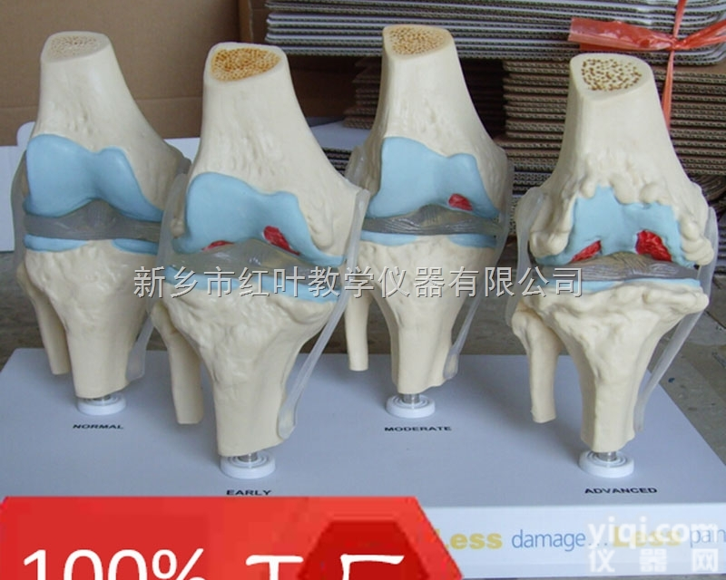 病理<em>膝关节</em><em>模型</em> <em>膝关节</em>