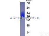 IL6  <em>白介素</em>6（IL6）真<em>核蛋白</em>