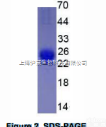 IL1RA  <em>白介素</em>1受体拮抗剂（IL1RA）真<em>核蛋白</em>