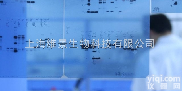 WB免疫印迹实验<em>服务</em>  <em>Western</em> Blot 免疫印迹实验<em>服务</em>（WB）