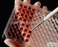 PCNA,小鼠抗增殖细胞核<em>抗原抗体</em><em>酶联免疫</em><em>试剂盒</em>