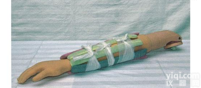 KAH/H340  <em>上臂</em><em>骨折</em><em>模型</em>