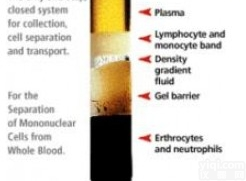 Individua  阳性<em>质控</em>人<em>血清</em>,血浆-Individual Units