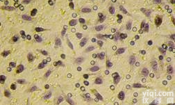 <em>侵袭</em>小室实验/transwell实验/细胞功能检测/细胞迁移与<em>侵袭</em>实验