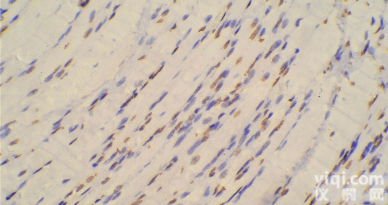 TUNEL实验<em>细胞</em>的<em>凋亡</em>检测