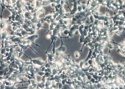 CLHKRXR02  美<em>国人</em>RXR alpha可<em>诱导</em>表达稳定<em>细胞株</em>