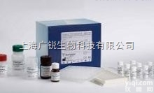 上海angiostatin 人<em>血管</em>抑素/<em>血管</em>稳定蛋白elisa 试剂盒