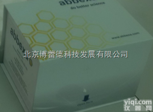 abx055408  Mouse <em>Glucocorticoid</em> <em>Receptor</em> <em>alpha</em>...