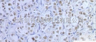 JRD0031  TUNEL（<em>冰冻</em>）<em>形态学</em>检测