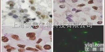 JRD0030  TUNEL（冰冻）<em>荧光</em><em>形态学</em>技术服务