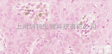 JRD0016  普鲁士蓝<em>染色</em>形态学<em>技术服务</em>