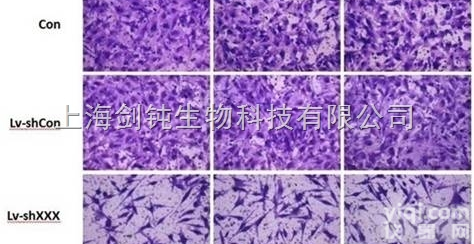 <em>Transwell</em><em>侵袭</em>实验