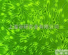 人脐静脉内皮细胞（人<em>膀胱</em><em>癌细胞</em>污染）；ECV-304<em>价格</em>